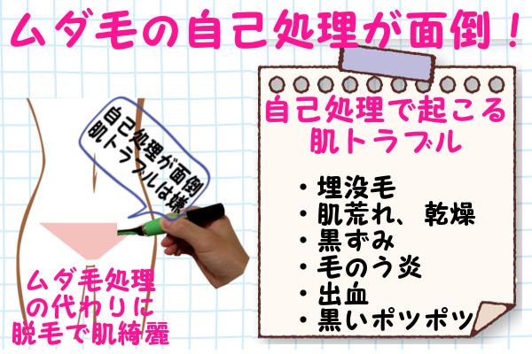 脱毛器ケノンでVIO脱毛！ムダ毛処理の代わりに脱毛で肌を綺麗な状態を保つ