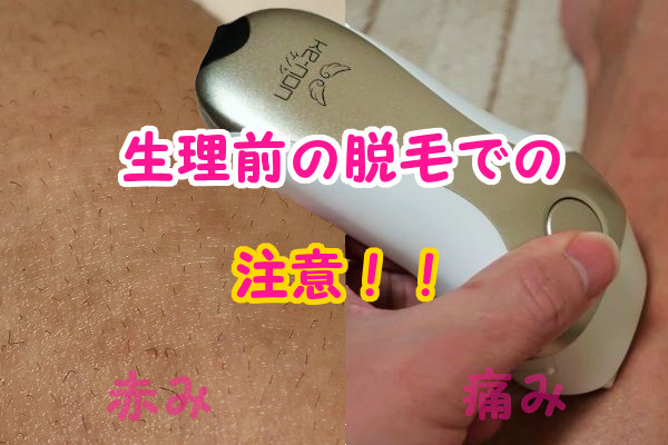 生理前のケノン脱毛での注意！赤みや痛み