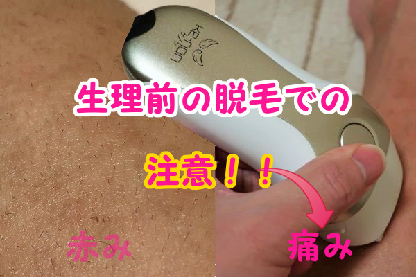 ケノンを生理前に使う時の注意！痛みを感じやすい