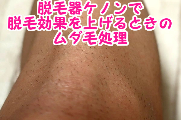 ムダ毛は剃ってからケノンを使うことが効果を上げるコツ