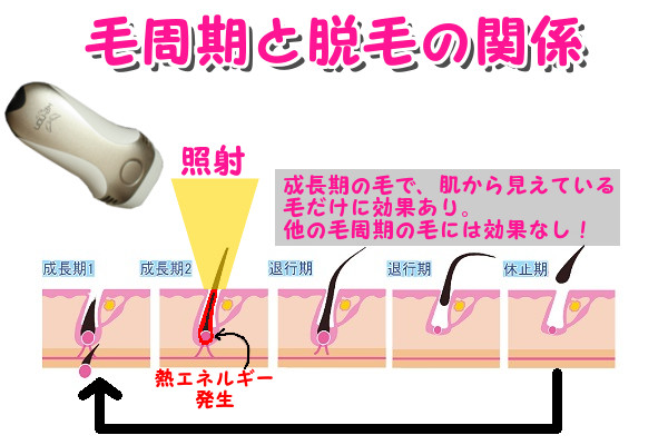 髭脱毛するとき、直前に髭を剃ると脱毛効果がないのはなぜ？毛周期との関係