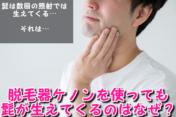 脱毛器ケノンを使って髭脱毛してもしつこく生えてくる！効果がない理由は何？