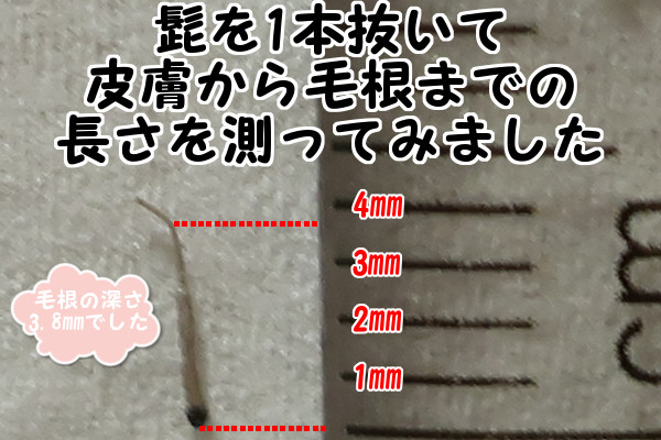 ケノンで髭脱毛！髭を1本抜いて皮膚から毛根までの長さを計ってみたら3.8mmだった