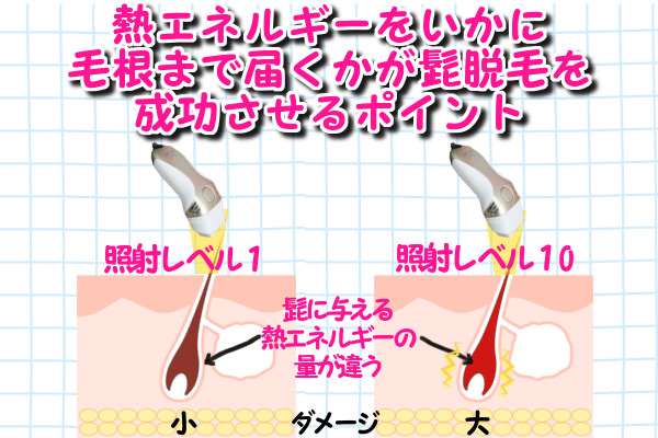 ケノンでの髭脱毛のポイントは・・・