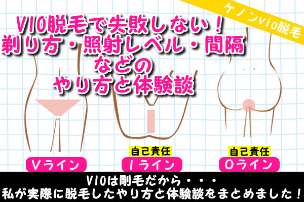 ケノンでvio脱毛できる！剃り方や照射レベル・間隔などやり方と体験談