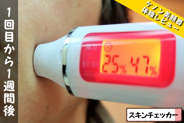 ケノン美顔器1回目使用から1週間後のスキンチェッカーの数値