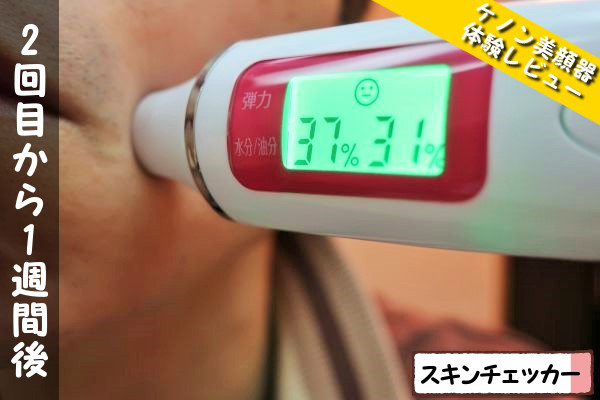 ケノン美顔器2回目使用から1週間後のスキンチェッカーの数値