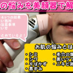 ケノン美顔器でシミ・シワ・ほうれい線・ニキビ・黒ずみ・乾燥などを改善するための使い方と照射頻度や脱毛効果など体験談をまとめています