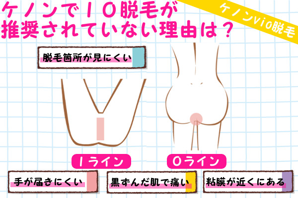 ケノンでIO脱毛はNG！理由と原因は？