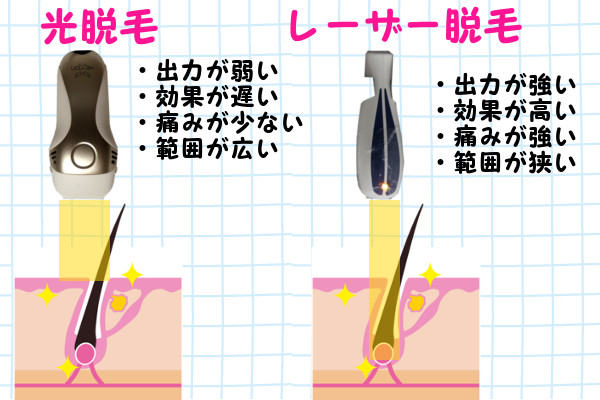 光脱毛とレーザー脱毛は何が違うの？