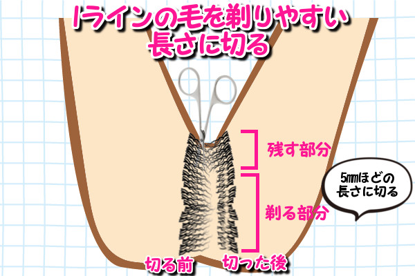 Iラインのムダ毛で剃る部分の長さを5mm程に剃る