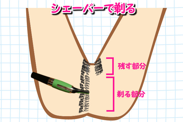 Iラインの剃る部分の毛をシェーバーで剃る