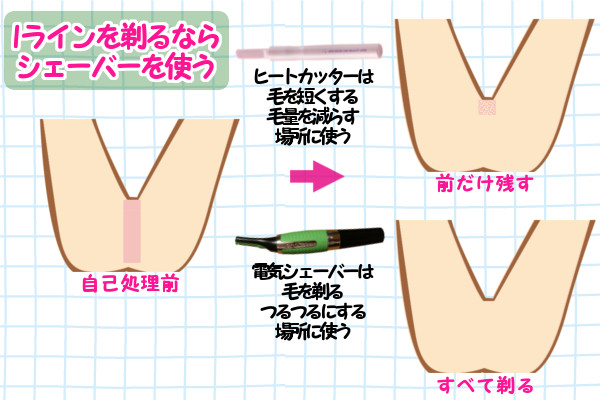 Iラインの毛を剃るなら電気シェーバーがおすすめ