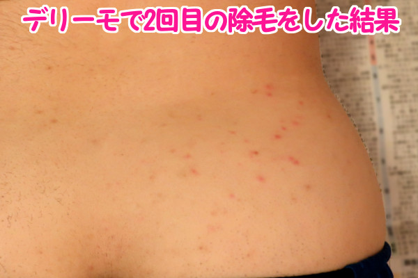 デリーモを使ってみた感想:2回目