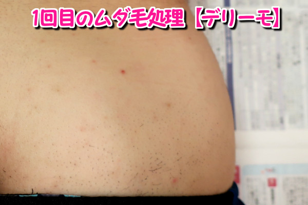 デリーモを使ってみた感想:1回目
