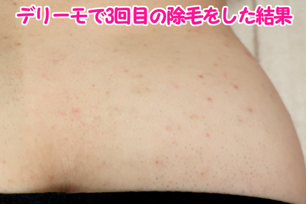 デリーモを使ってみた感想:3回目