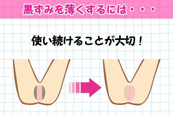 黒ずみ専用クリームは薄くなるまで使い続けることが大切