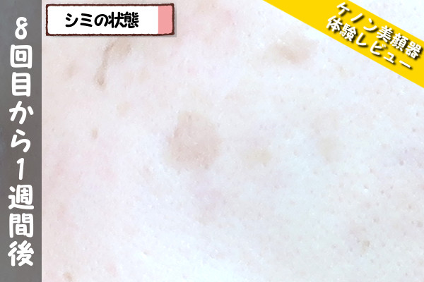 ケノン美顔器の8回目使用から1週間後のシミの状態
