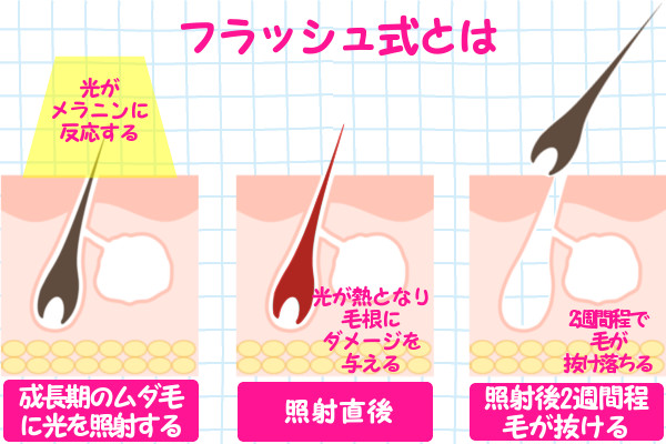 ケノンとノーノーヘアの違いを比較！どっちの脱毛器を選ぶのが良い？