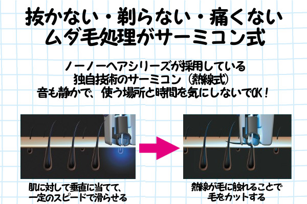 ケノンとノーノーヘアの脱毛方式の違い