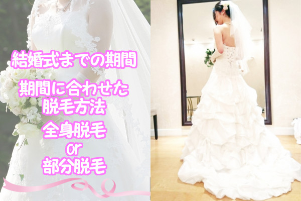 結婚式までの期間別おすすめ脱毛