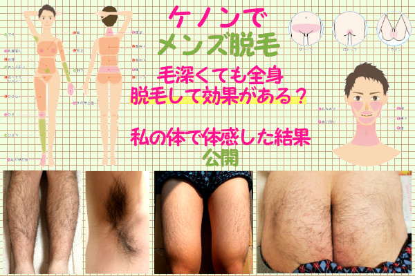 ケノンでメンズ脱毛！男の髭・すね毛への効果と完了までの期間を解説