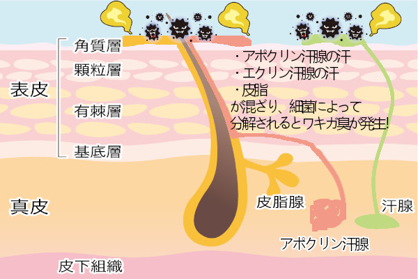 ワキガ臭の原因は？