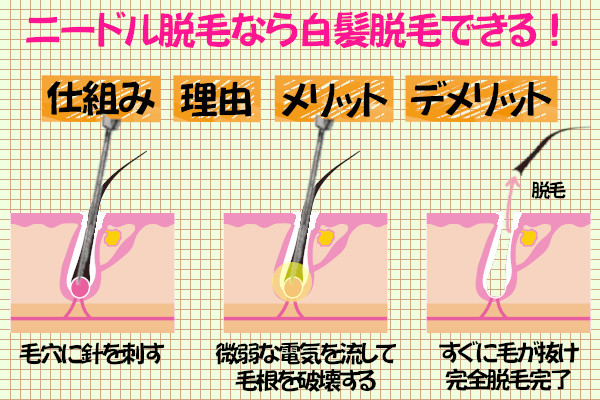 白髪脱毛できるニードル脱毛の理由