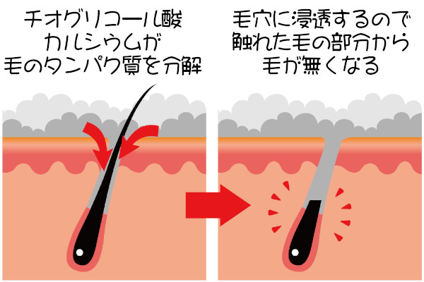 ムダ毛のタンパク質を分解して処理する