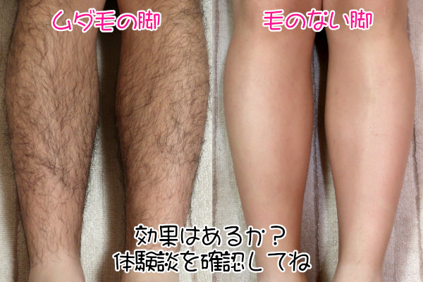 ケノンは脱毛効果があるの？