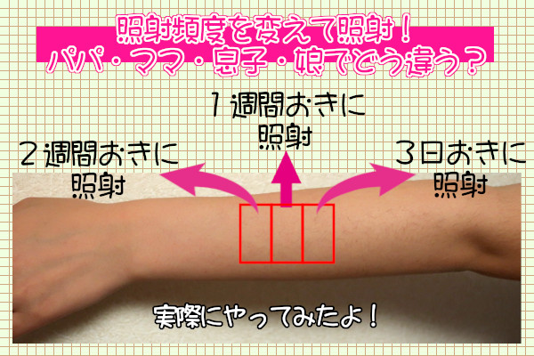 ケノンの脱毛効果を早く感じる照射頻度は？