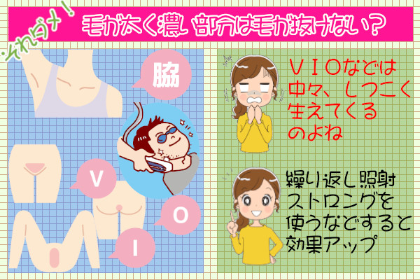 ケノンで脱毛後、毛が抜けないのは剛毛だから