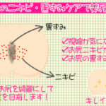 お尻の黒ずみをケアできるクリームで美尻を作る！汚いお尻よサヨナラ