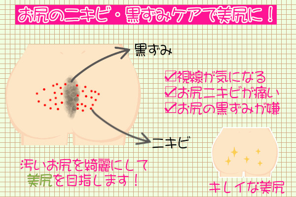 お尻の黒ずみをケアできるクリームで美尻を作る！汚いお尻よサヨナラ