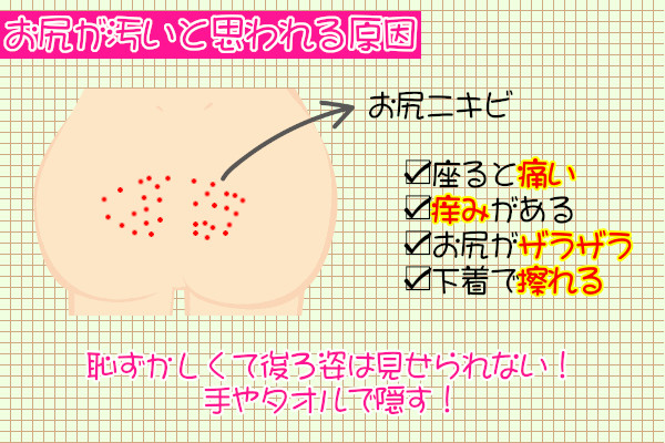 お尻が汚い原因はニキビ