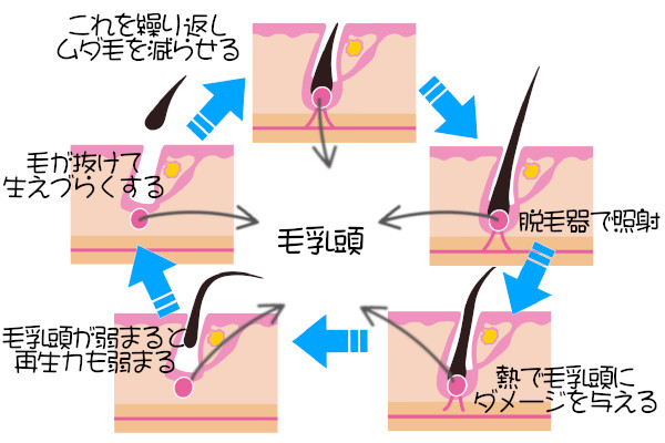 なぜ、成長期の毛だけ脱毛できるの？